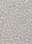 Expression and Purification of the Eukaryotic MBP-MOS1 Transposase from Sf21 Insect Cells