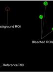 Fluorescence Recovery after Photobleaching (FRAP) Assay to Measure the Dynamics of Fluorescence Tagged Proteins in Endoplasmic Reticulum Membranes of Plant Cells
