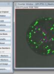 Measurement of the Number of Peroxisomes