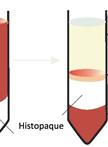 Isolation and Characterisation of Dendritic Cells from Peripheral Blood