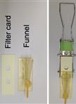 Detection of ALT Associated Promyelocytic Leukemia Nuclear Bodies (APBs) by Immunofluorescence-FISH (IF-FISH)