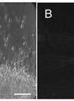 In vitro Migration Assays for Neural Stem Cells, Intermediate Neurogenic Progenitors and Immature Neurons