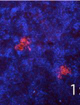 Infection Experiments (Hepatitis C Virus)