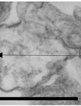 Preparation of Synaptosomes from the Motor Cortex of Motor Skill Trained Mice
