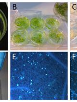 Staining of Callose Depositions in Root and Leaf Tissues