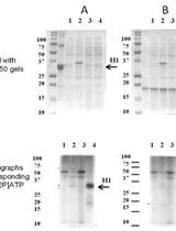 Substrate Specificity of Recombinant Ser/Thr Protein Kinase