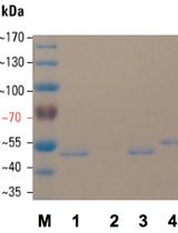 Rapid Preparation of Unsheathed Bacterial Flagella 