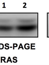 Detection of Phospho-KRAS by Electrophoretic Mobility Change in Human Cell Lines and in Tumor Samples from Nude Mice Grafts