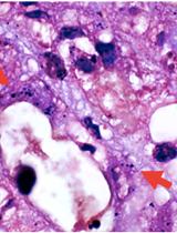 Gram Stain for Intestinal Bacteria