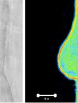 Arabidopsis thaliana Root Hair Cell Cytoplasmic pH (pHc) Imaging 