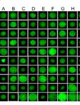 Cyst Detection in Toxoplasma gondii Infected Mice and Rats Brain