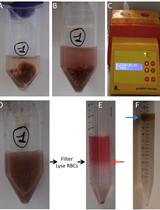 Murine Liver Myeloid Cell Isolation Protocol 