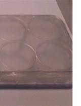 Proximity Ligation Assay (PLA) to Detect Protein-protein Interactions in Breast Cancer Cells 