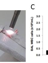 Non-invasive Intratracheal Instillation in Mice