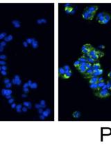 Metabolic Assays for Detection of Neutral Fat Stores