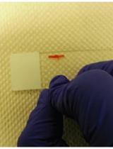 Mouse Models of Uncomplicated and Fatal Malaria