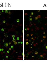 Detection of Alternative Oxidase Expression in Arabidopsis thaliana Protoplasts Treated with Aluminium
