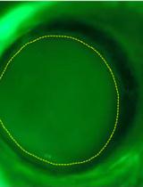 Animal Models of Corneal Injury