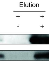 Protein Immunoprecipitation Using Nicotiana benthamiana Transient Expression System
