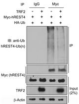 Identification of Factors in Regulating a Protein Ubiquitination by Immunoprecipitation: a Case Study of TRF2 on Human REST4 Ubiquitination