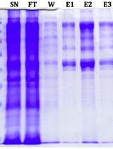 Expression and Purification of the Arabidopsis E4 SUMO Ligases PIAL1 and PIAL2