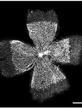 Mouse Retinal Whole Mounts and Quantification of Vasculature Protocol