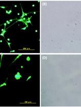 Visualization of ex vivo Neutrophil Extracellular Traps by Fluorescence Microscopy