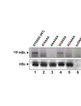 Detection of HBV C Protein Phosphorylation in the Cell