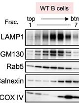 Separation of Intracellular Vesicles for Immunoassays