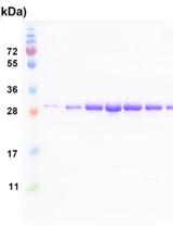 Sample Preparation of Telomerase Subunits for Crystallization