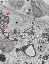 Morphological Quantification of Nuclei and Mitochondria in  Serial Block-face Scanning Electron Microscopy Images