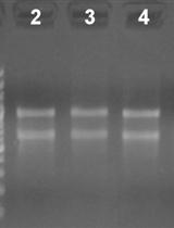 对拟南芥样本的cDNA 3'末端进行快速扩增（3' RACE）