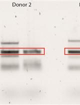对EBV 和CMV特异性人CD8+T淋巴细胞的TCRβ克隆型分析