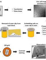 Sample Preparation for Correlative Light and Electron Microscopy (CLEM) Analyses in Cellular Microbiology