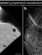 Intravenous Tomato Lectin Injection to Assess Functional Vasculature