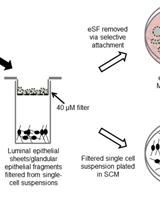Isolation and Culture of Human Endometrial Epithelial Cells and Stromal Fibroblasts