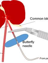 Clonal Culture of Mouse Liver Progenitor Cells