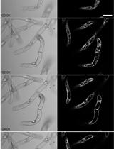 Vacuole Structure Analysis during Cell Death Subsequent to Application of Erwinia carotovora Culture Filtrates to Cell Cultures of Nicotiana tabacum