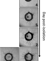 Rat Aortic Ring Model to Assay Angiogenesis <em>ex vivo</em>