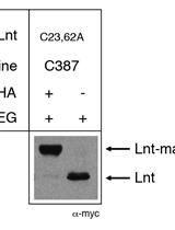 Substituted Cysteine Accessibility Method for Topology and Activity Studies of Membrane Enzymes Forming Thioester Acyl Intermediates in Bacteria