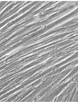 Skeletal Myogenesis in vitro