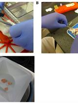 13C 示踪研究老鼠肿瘤异种移植中的新陈代谢