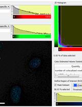 Telomere Dysfunction Induced Foci (TIF) Analysis
