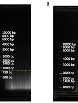 Telomere Restriction Fragment (TRF) Analysis