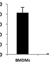 Purification of Bacterial RNA from Infected Macrophages