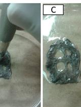 Estimation of Wound Tissue Neutrophil and Macrophage Accumulation by Measuring Myeloperoxidase (MPO) and N-Acetyl-β-D-glucosaminidase (NAG) Activities