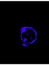 Single Molecule RNA FISH in the Mammalian Oocyte