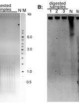 Terminal Restriction Fragments (TRF) Method to Analyze Telomere Lengths