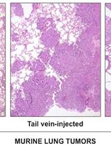 Analysis of Murine Lung Tumors by Micro PET-CT Imaging