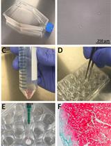Porous Scaffold Seeding and Chondrogenic Differentiation of BMSC-seeded Scaffolds